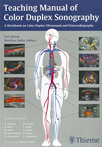 Teaching Manual of Color Duplex Sonography: A workbook on color duplex ultrasound and echocardiography. Forew. by Arnost Fronek